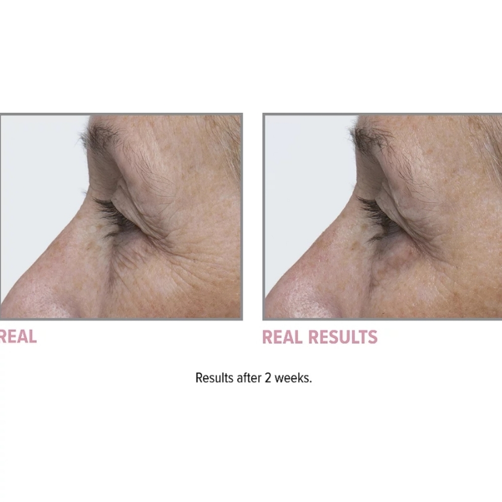 SAMPLE SZ. IT COSMETICS CONFIDENCE IN AN EYE CREAM - Picture 5 of 8